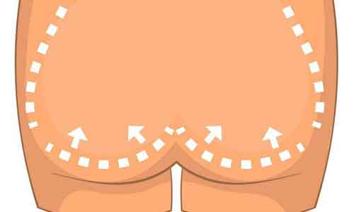 <a href='/' target='_blank'><u>上海美莱</u></a>远征探美之可可西里守护行动动圆满落幕