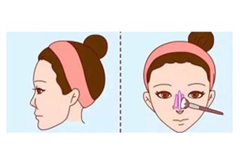 美莱被艾尔建授予“钻石医院”称号