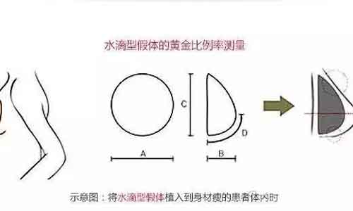 上海做一般在开眼角多少钱