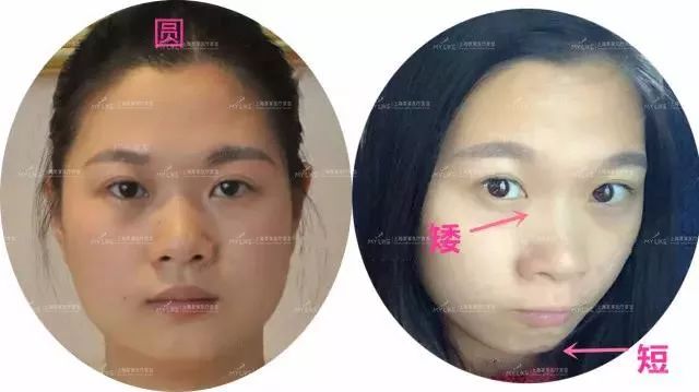 私密仪器收紧有效果吗