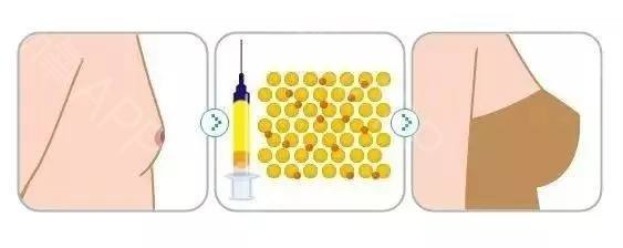 脸上长了很多斑点,怎么去掉啊
