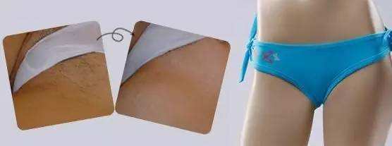 脸上长了很多斑点,怎么去掉啊