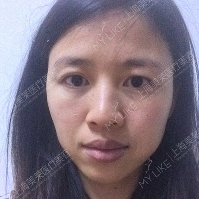 上海菲蜜丽私密整形医院哪家好