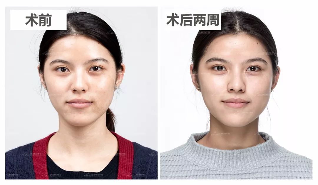 美莱珠宝品鉴会“邂逅巴黎·璀璨人生”