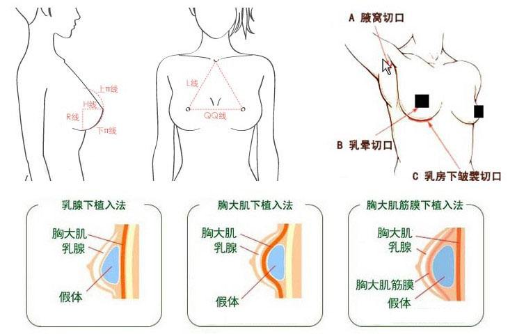 上海美莱20周年庆，全线整形8折