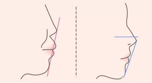 上海做半较久纹眉哪家医院比较好