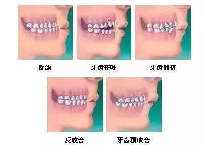 上海美莱周年庆正式开启，六大爆款520元