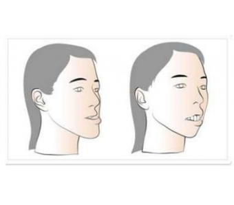 和水光针哪个补水效果好