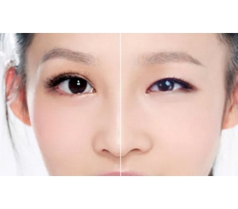 南中国瘦脸针注射医师培训会在上海美莱圆满落幕