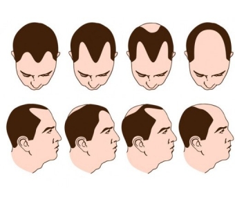 南中国瘦脸针注射医师培训会在上海美莱圆满落幕