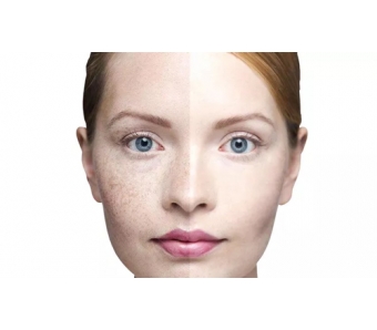 南中国瘦脸针注射医师培训会在上海美莱圆满落幕