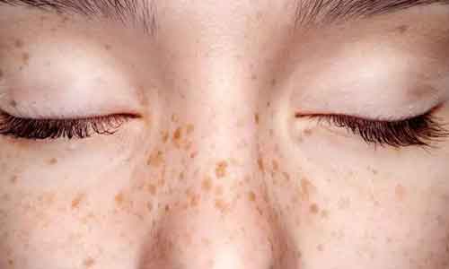 美莱菲蜜青私密抗衰效果怎么样