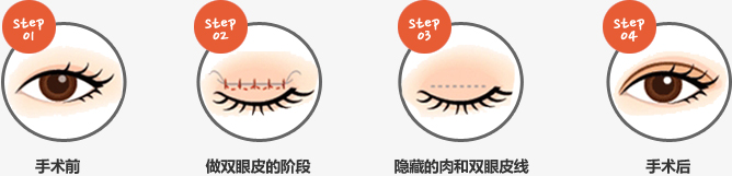 泉州美莱受邀落户丰泽区,成为医美旗舰医院