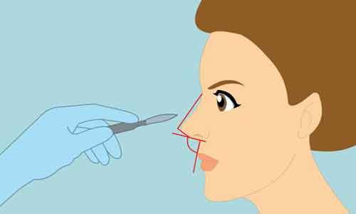 美莱医院举办《太平盛世,制扇至美》 沙龙活动