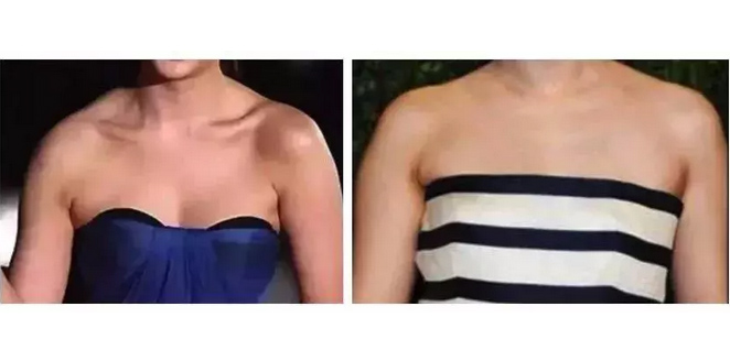 痘痘没有了脸上留下了很多痘印怎么消除