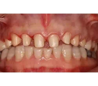 上海美莱万圣节,来院就送梦幻星空糖果礼盒