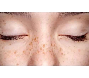 美莱举办【逆龄有术?青春魔法】抗衰除皱沙龙