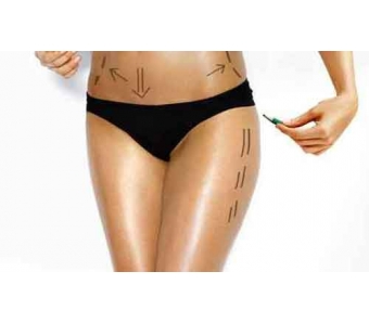 上海双眼皮整形手术大概需要多少钱