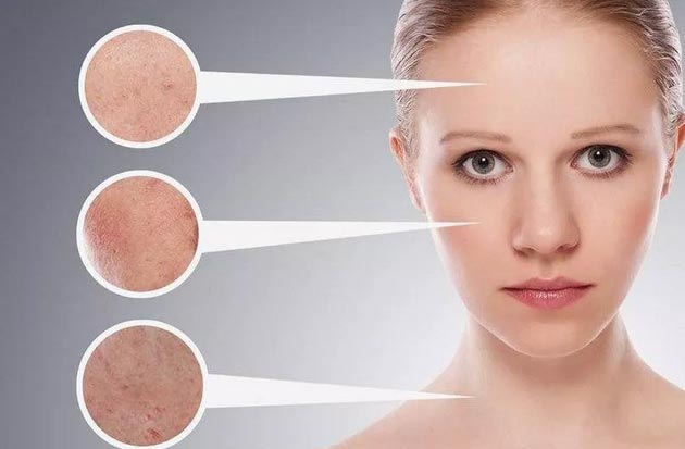 美莱携手高德美皮下玻尿酸填充进修班