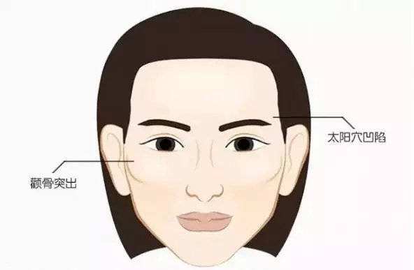 美莱携手高德美皮下玻尿酸填充进修班