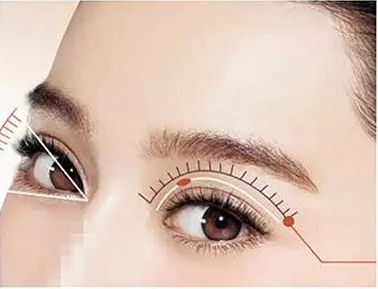 上海做开眼角手术需要多少钱