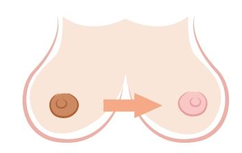 激光脱毛能不能达到较久的效果