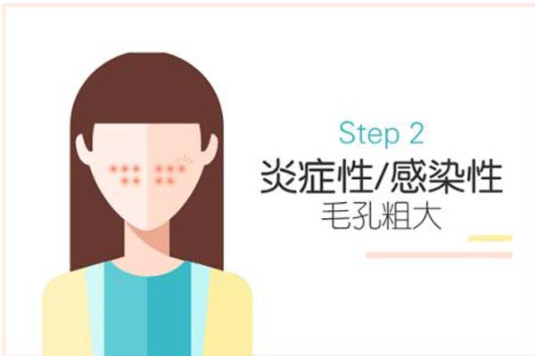 大门牙牙齿有点突出怎么矫正