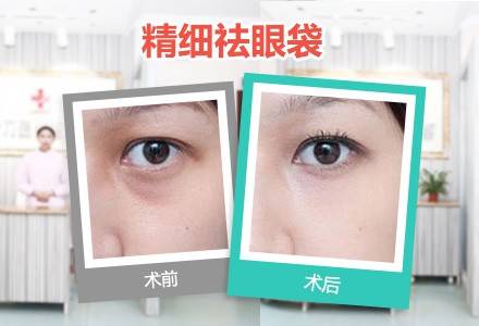 小肚子很大很多肉怎么才能减肥