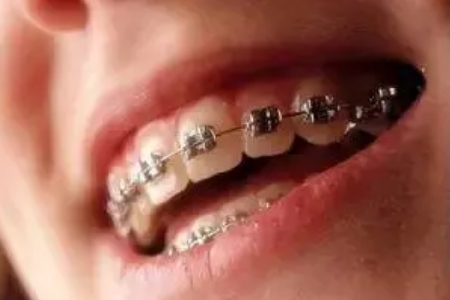 美莱20th周年庆,前50到院即送礼