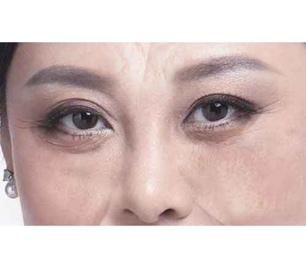 艾尔建组织瘦脸针注射培训会,邀请美莱参加