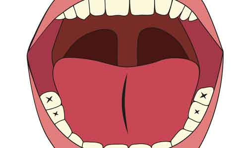 做激光脱毛大概需要多少钱