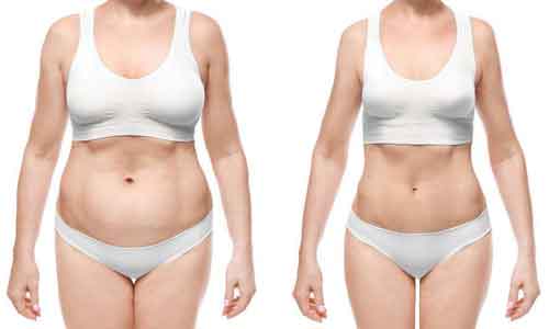 美莱承办2018年黄褐斑高峰论坛