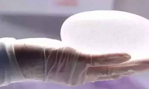 美莱口腔科举办隐形牙齿矫正交流会