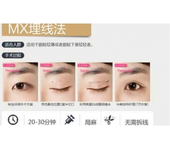 割完双眼皮术后怎么才能快速恢复自然