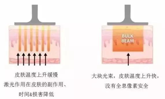 玻尿酸注射隆鼻效果能保持多久