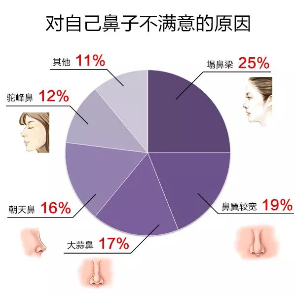 手臂很粗怎么才能减下来