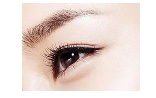 割双眼皮会不会留疤啊