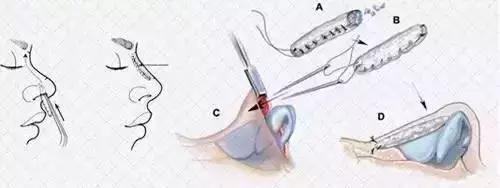 美莱受邀出席2018中国医师协会