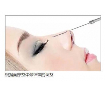 玻尿酸隆鼻会不会留疤呢