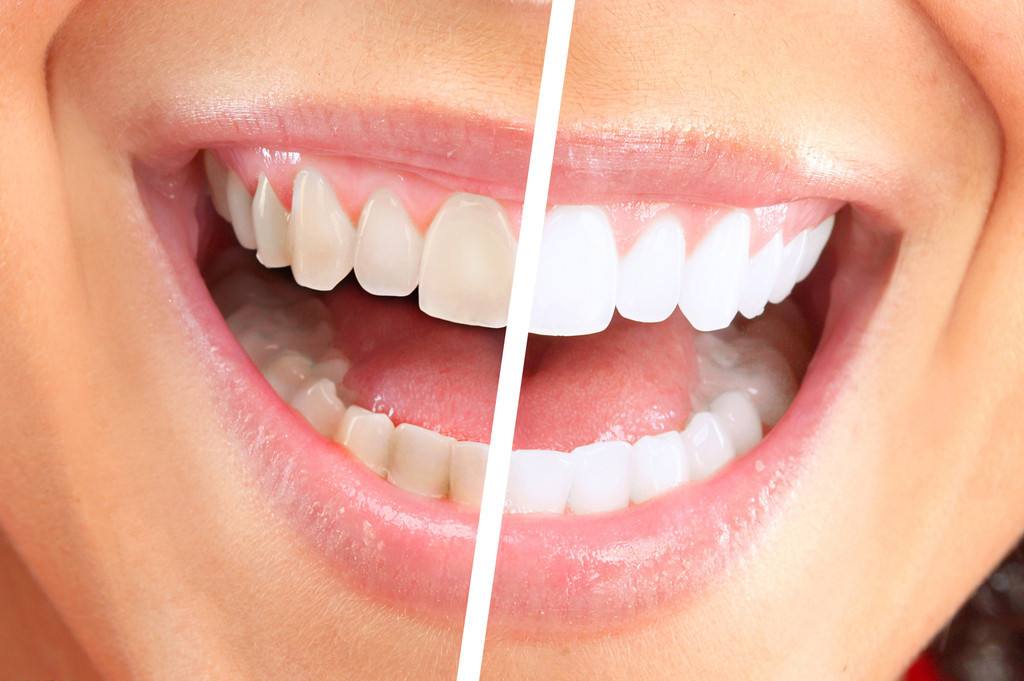 上海面部吸脂医院哪家好