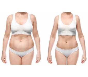 美莱承办“2018隐适美隐形矫正西南高峰论坛”