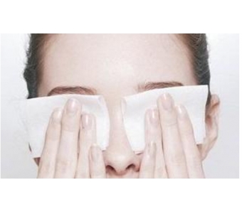 哪些人适合做埋线双眼皮