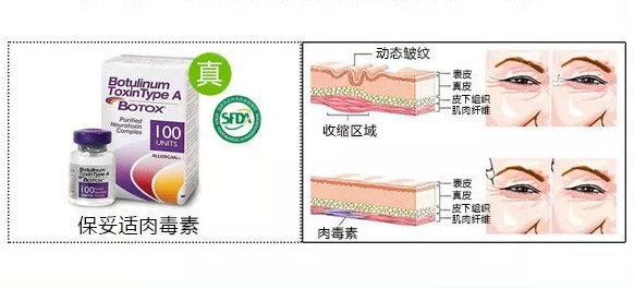 在上海做吸脂祛眼袋手术安全吗