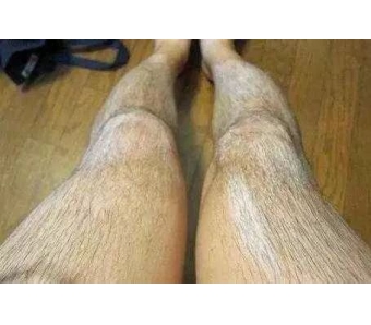 天生嘴唇就很薄怎么才能改善啊