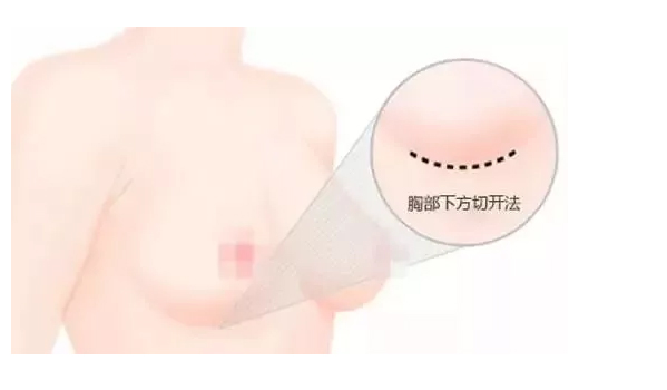 美莱医院空降冻龄除皱男神