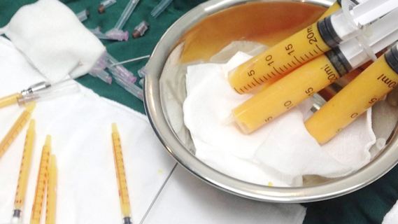 腰部吸脂术后要穿多久的塑身衣