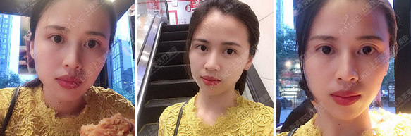 上海鼻部整形去哪家医院比较好