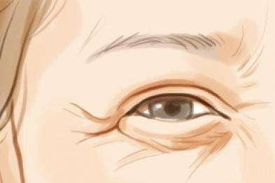 假体隆胸术后多久可以穿文胸