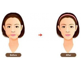 上海做韩式双眼皮哪家好