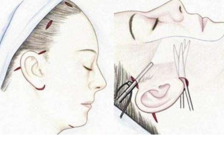 苏州美莱盛大开业，谱写新美莱